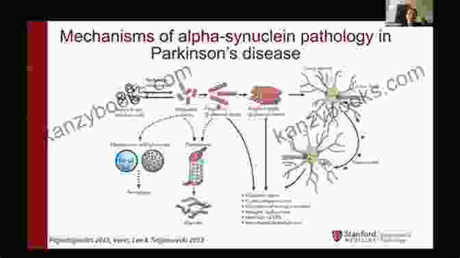 α Synuclein Seeds In Parkinson's Disease Proteopathic Seeds And Neurodegenerative Diseases (Research And Perspectives In Alzheimer S Disease)