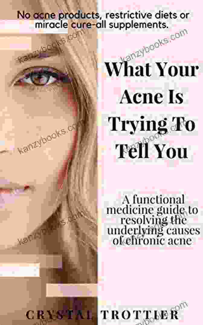 Functional Medicine Guide To Resolving The Underlying Causes Of Chronic Acne What Your Acne Is Trying To Tell You: A Functional Medicine Guide To Resolving The Underlying Causes Of Chronic Acne