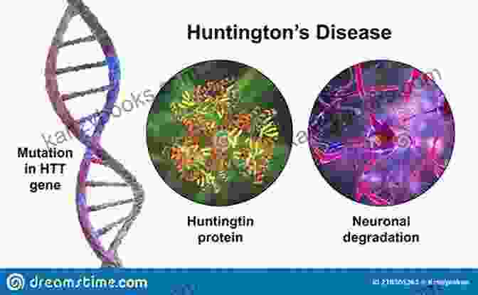 Huntingtin Seeds In Huntington's Disease Proteopathic Seeds And Neurodegenerative Diseases (Research And Perspectives In Alzheimer S Disease)
