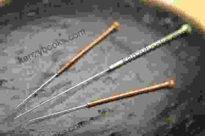 Image Of Acupuncture Needles Chi Healing Powers Set